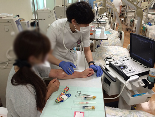 エコー装置を使用した自己穿刺指導